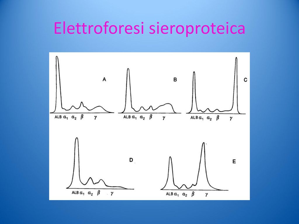 Elettroforesi sieroproteica
