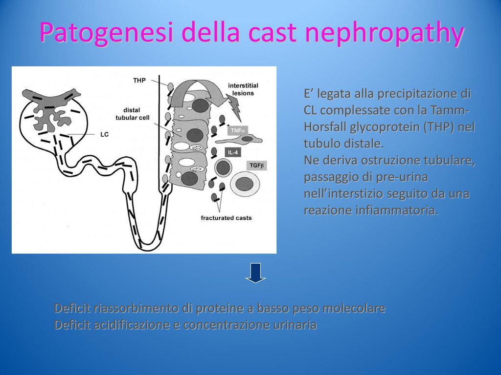Patogenesi della cast nephropathy