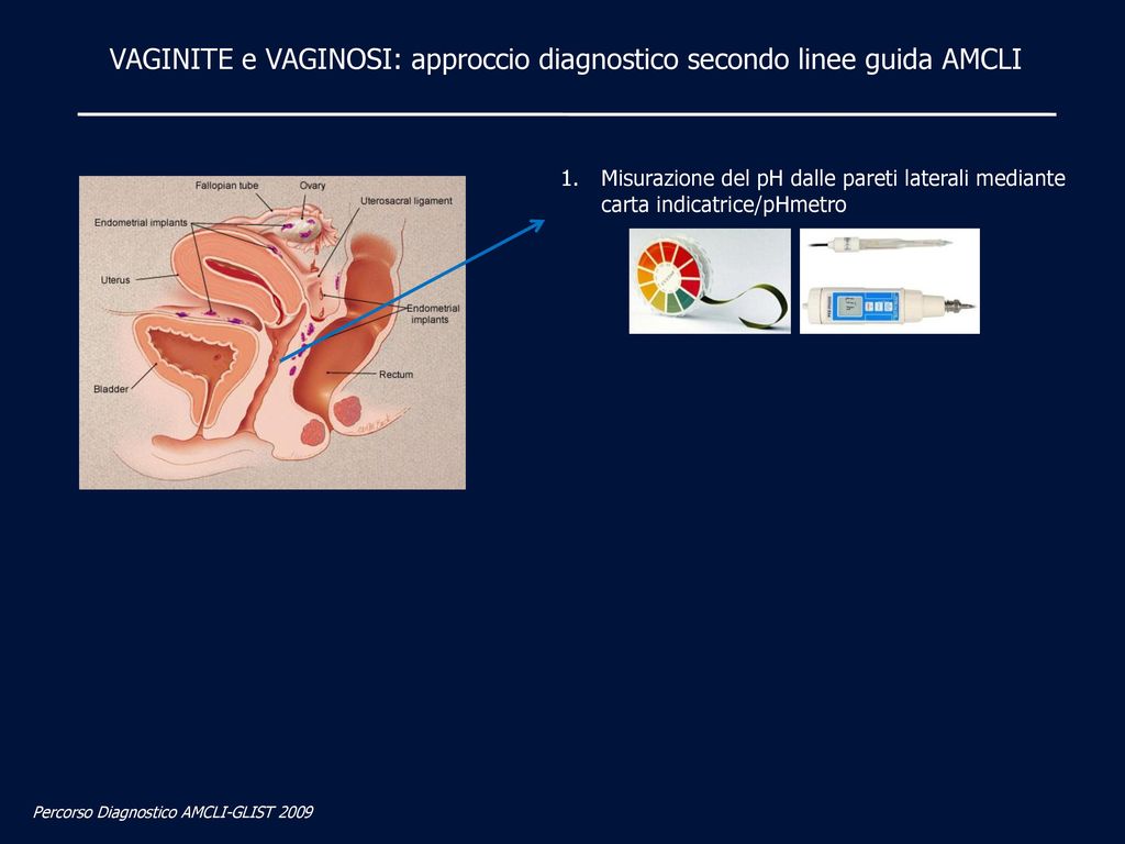 VAGINITE e VAGINOSI: approccio diagnostico secondo linee guida AMCLI