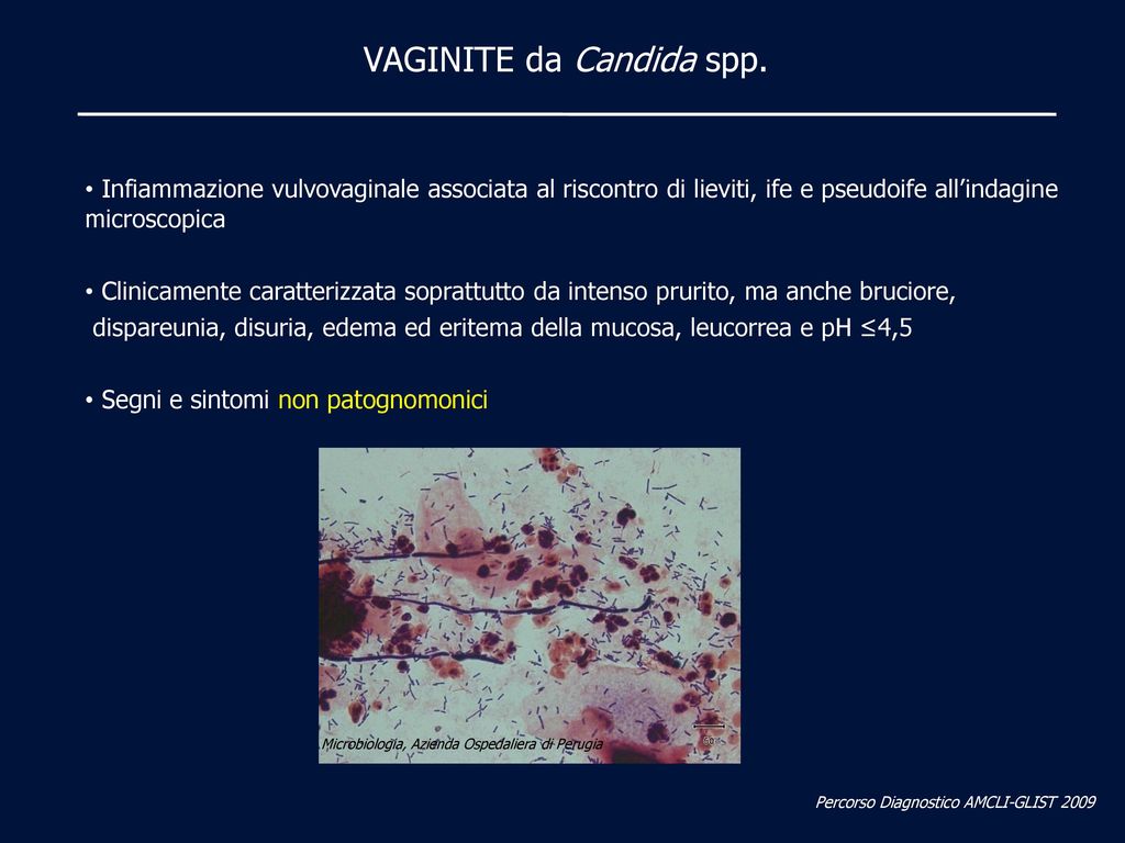 VAGINITE da Candida spp.