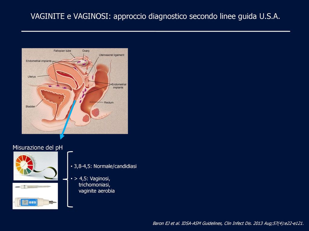 VAGINITE e VAGINOSI: approccio diagnostico secondo linee guida U.S.A.