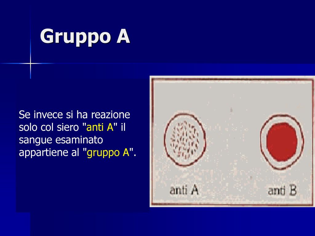 Gruppo A Se invece si ha reazione solo col siero anti A il sangue esaminato appartiene al gruppo A .
