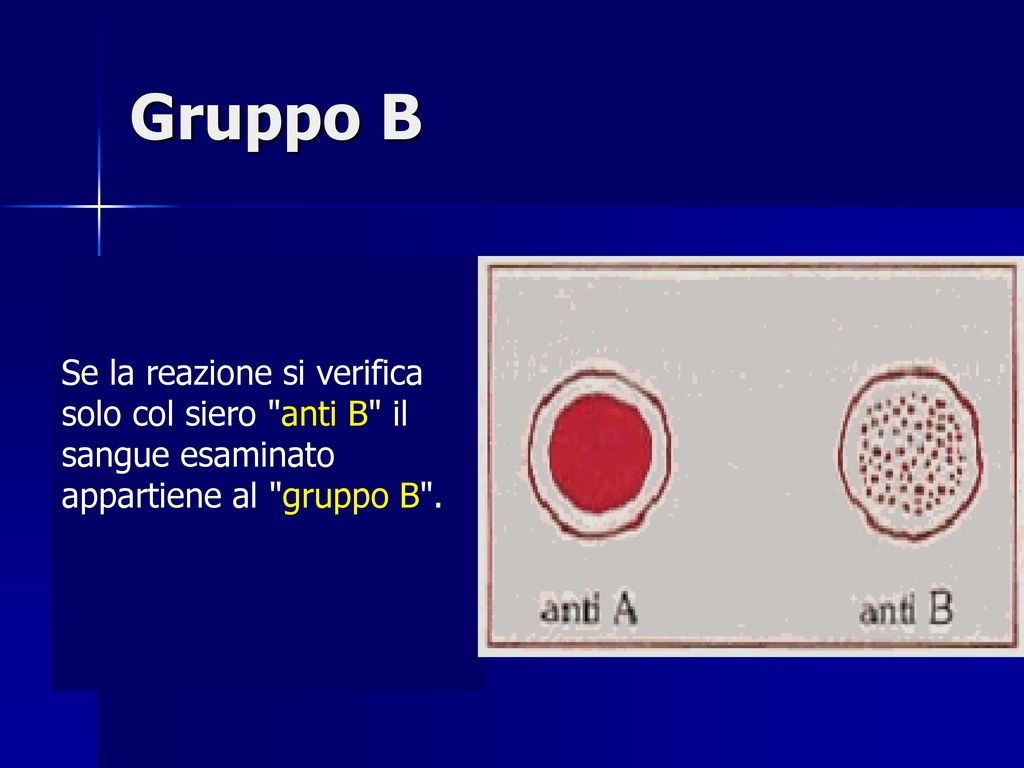 Gruppo B Se la reazione si verifica solo col siero anti B il sangue esaminato appartiene al gruppo B .