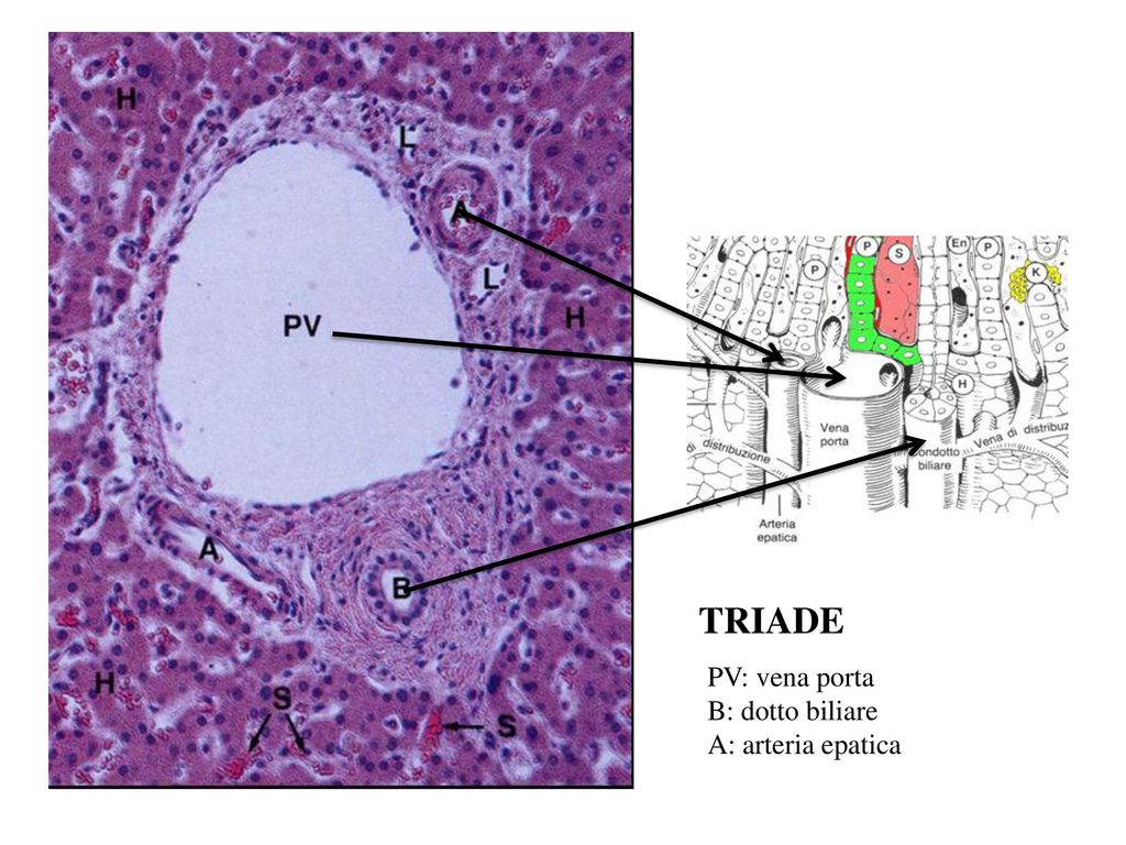 TRIADE PV: vena porta B: dotto biliare A: arteria epatica