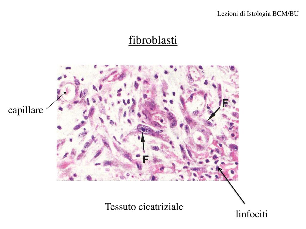 fibroblasti capillare Tessuto cicatriziale linfociti