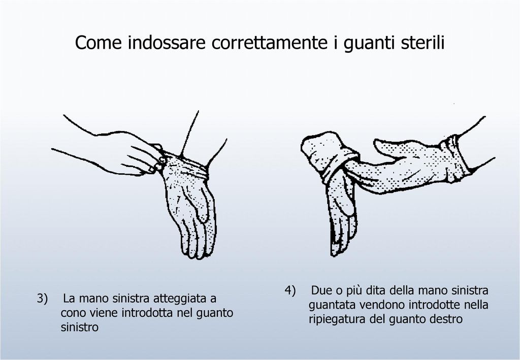 Come indossare i guanti sterili 