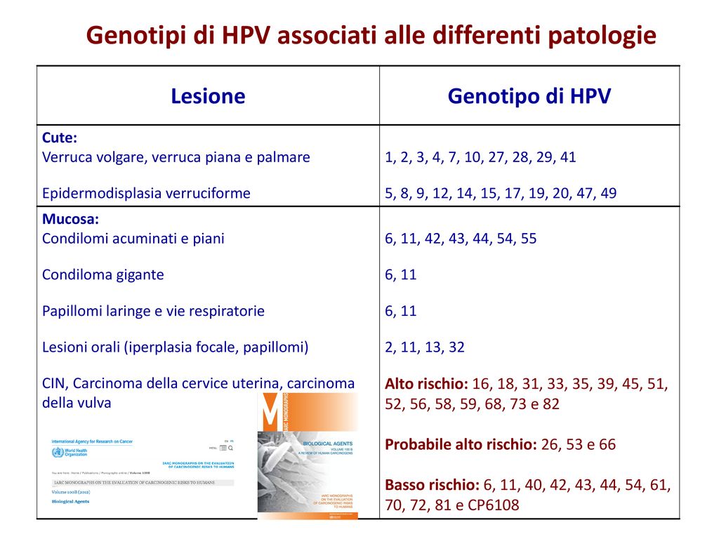 Papilloma virus genotipi ad alto rischio, Genotipi hpv ad alto rischio