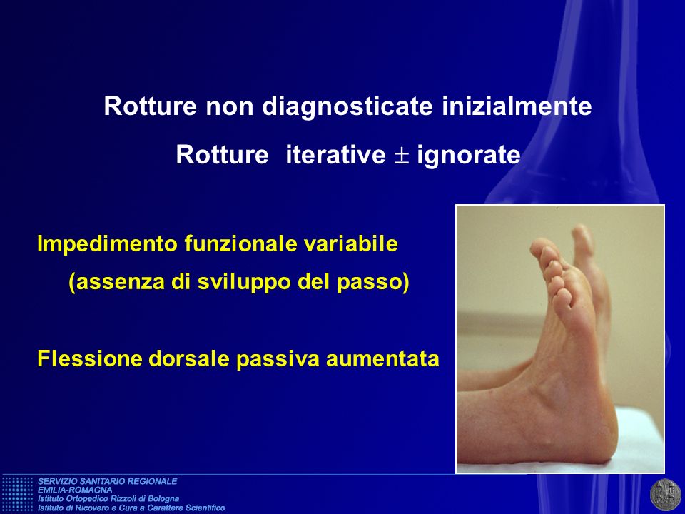 Rotture non diagnosticate inizialmente Rotture iterative  ignorate