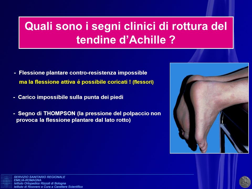 Quali sono i segni clinici di rottura del tendine d’Achille