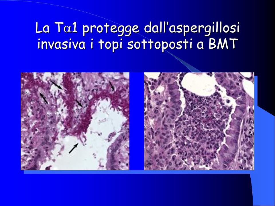 La T1 protegge dall’aspergillosi invasiva i topi sottoposti a BMT