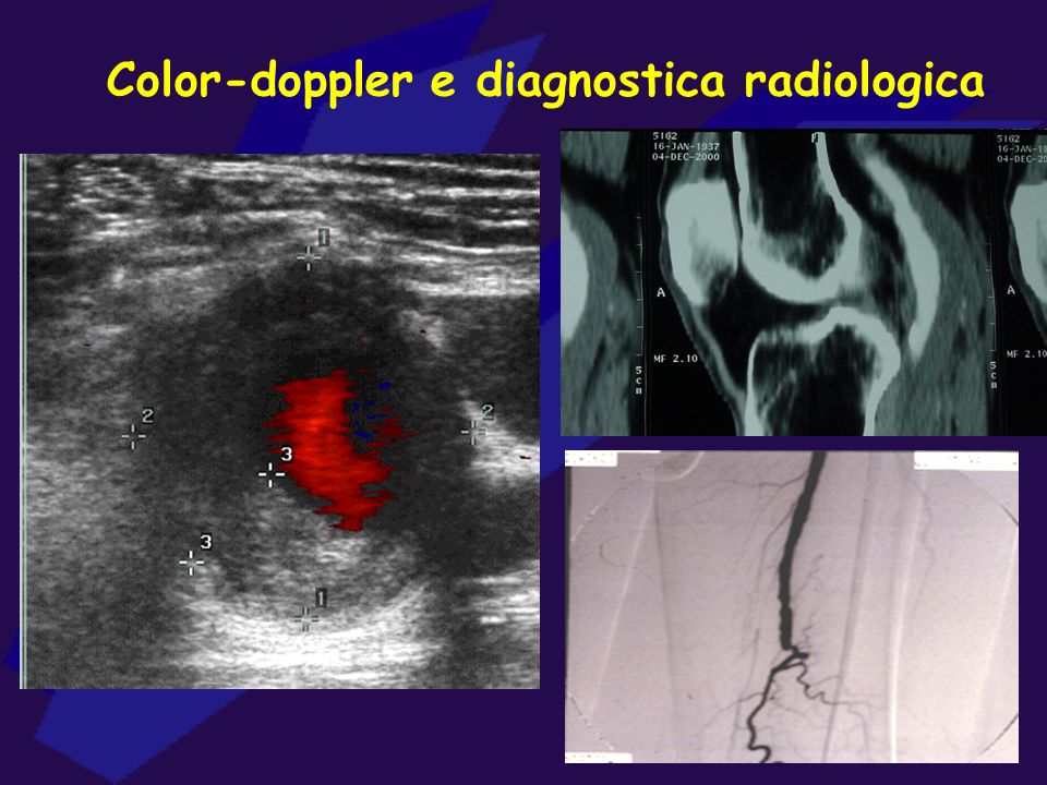 Color-doppler e diagnostica radiologica