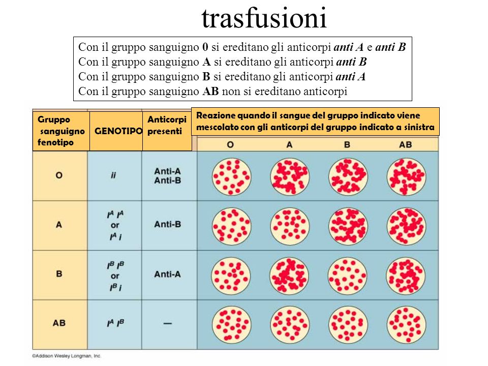 trasfusioni Con il gruppo sanguigno 0 si ereditano gli anticorpi anti A e anti B. Con il gruppo sanguigno A si ereditano gli anticorpi anti B.