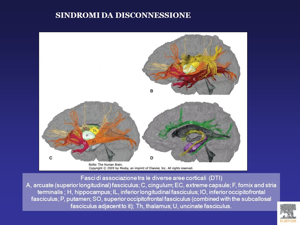 Fasci di associazione tra le diverse aree corticali (DTI)