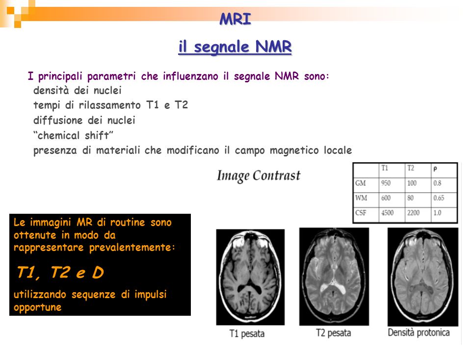 MRI il segnale NMR. I principali parametri che influenzano il segnale NMR sono: densità dei nuclei.
