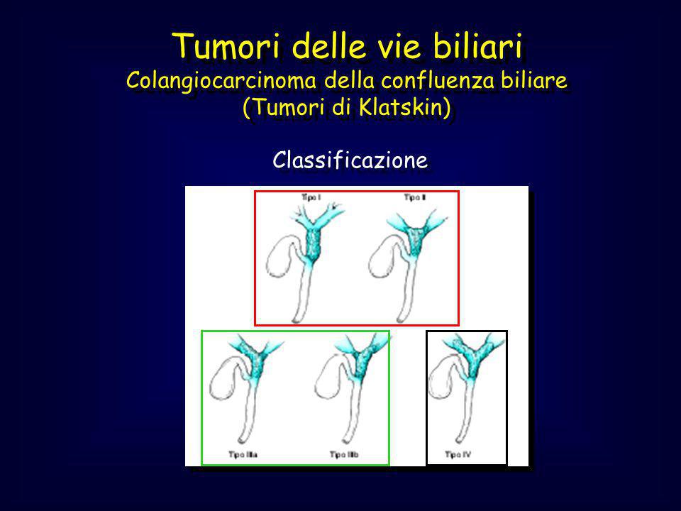 Tumori delle vie biliari Colangiocarcinoma della confluenza biliare (Tumori di Klatskin)