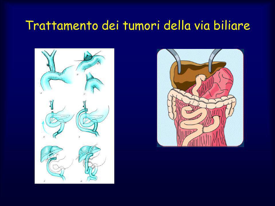 Trattamento dei tumori della via biliare