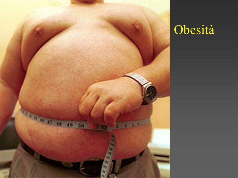 Obesità