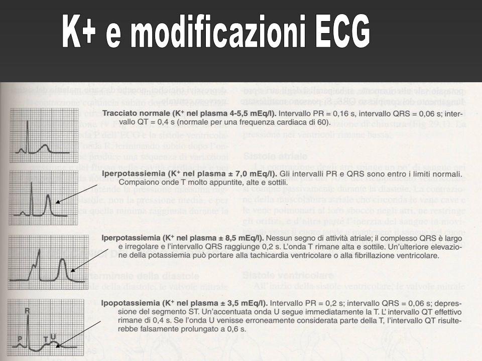 K+ e modificazioni ECG