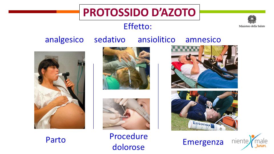 Protossido d'azoto: meccanismo di azione, gestione ed effetti collaterali