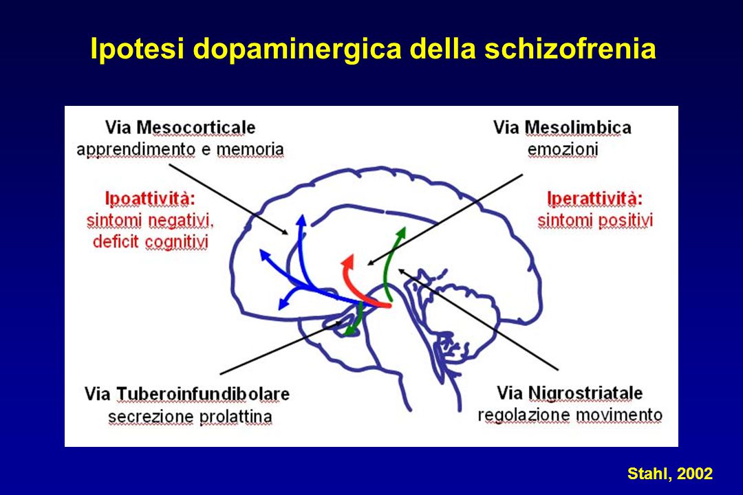 Ipotesi dopaminergica della schizofrenia