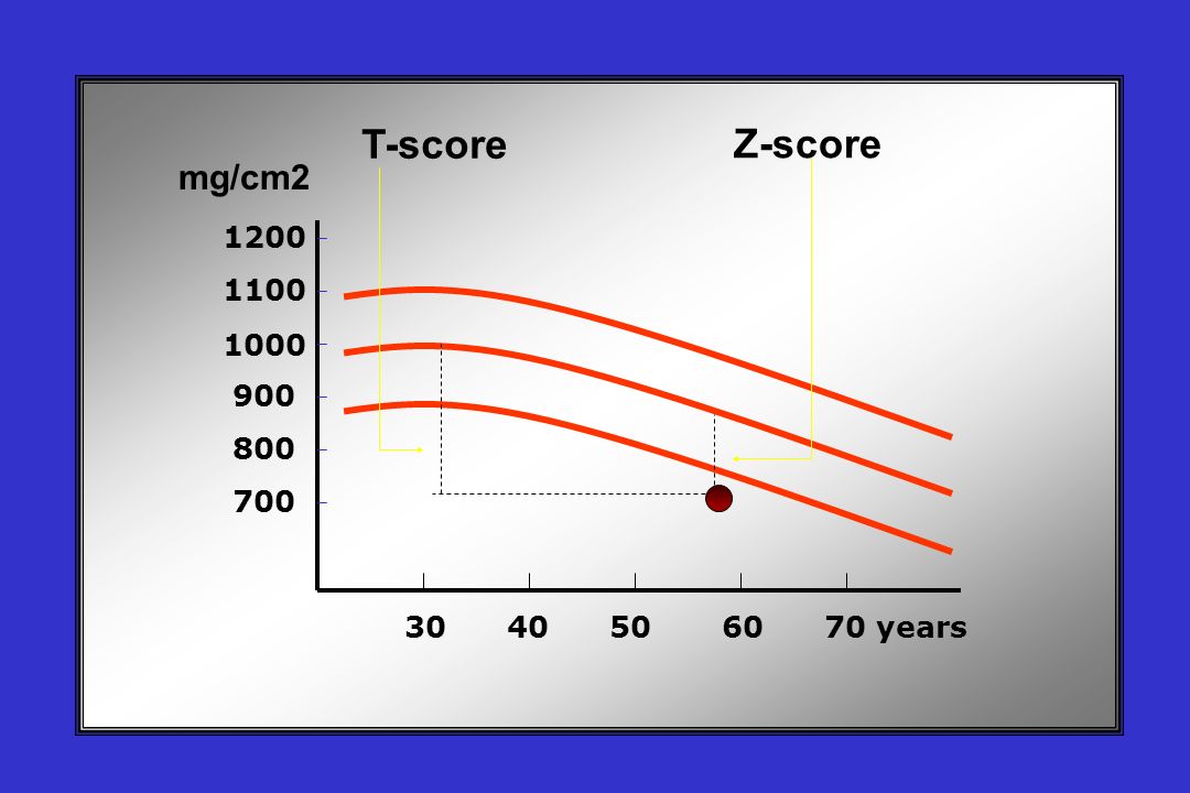 T-score Z-score mg/cm years