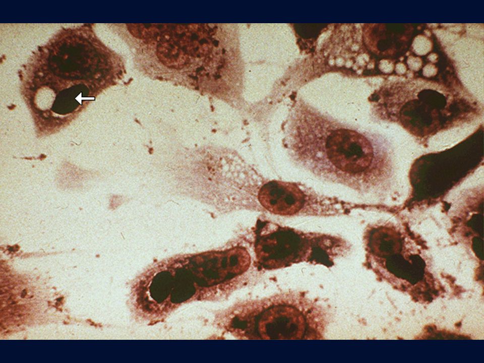 Chlamydia pneumoniae in coltura di cellule McCoy, microcolonie iodofile.