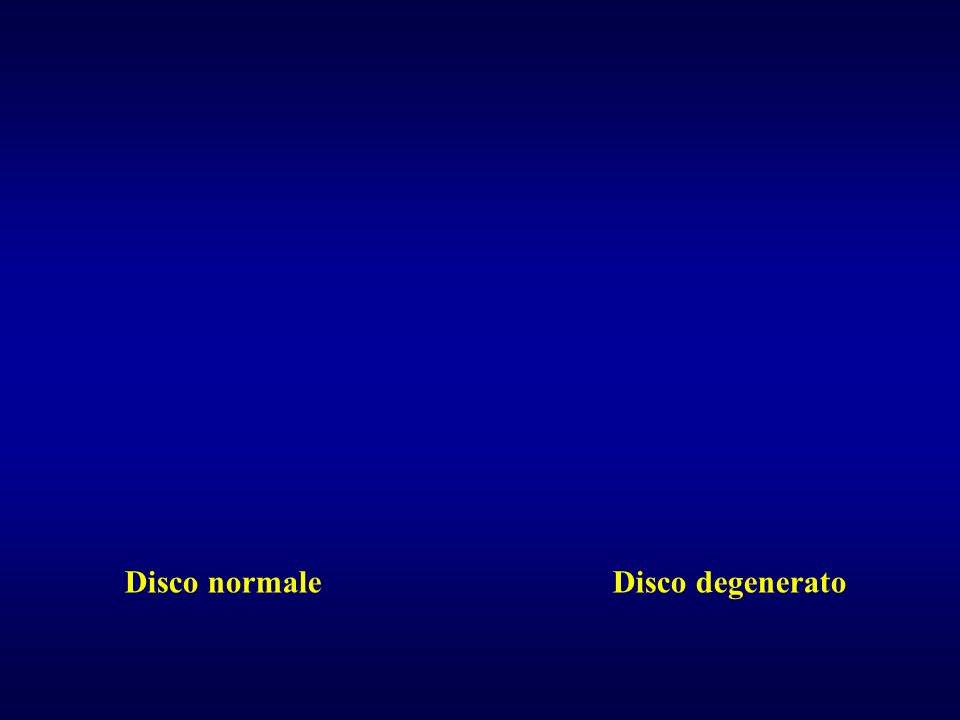 Disco normale Disco degenerato
