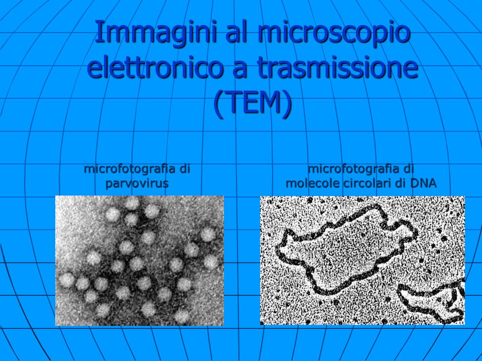Osservazioni al microscopio elettronico a trasmissione: cellule
