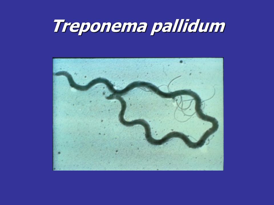 Бледная трепонема treponema pallidum. Бледная спирохета микробиология.