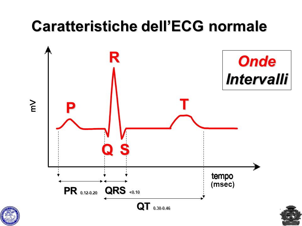 Caratteristiche dell’ECG normale