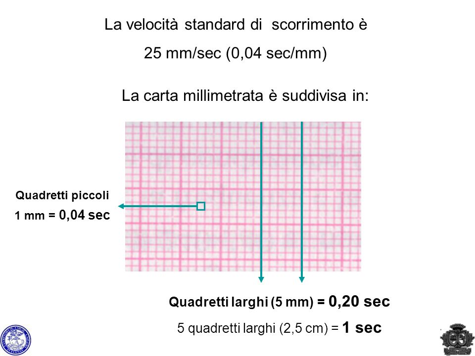 La velocità standard di scorrimento è 25 mm/sec (0,04 sec/mm)