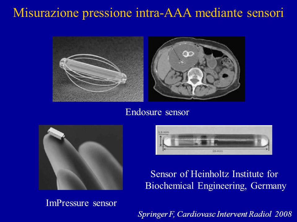 Misurazione pressione intra-AAA mediante sensori