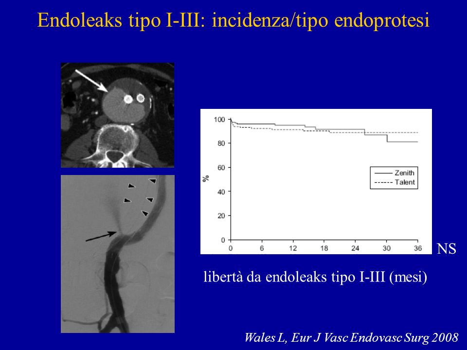 Endoleaks tipo I-III: incidenza/tipo endoprotesi