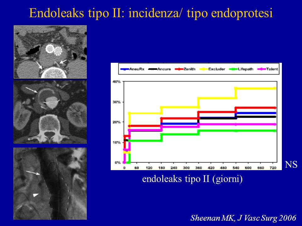 Endoleaks tipo II: incidenza/ tipo endoprotesi