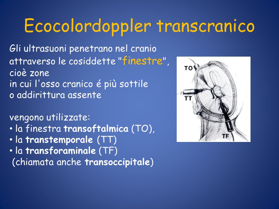 Ecocolordoppler transcranico