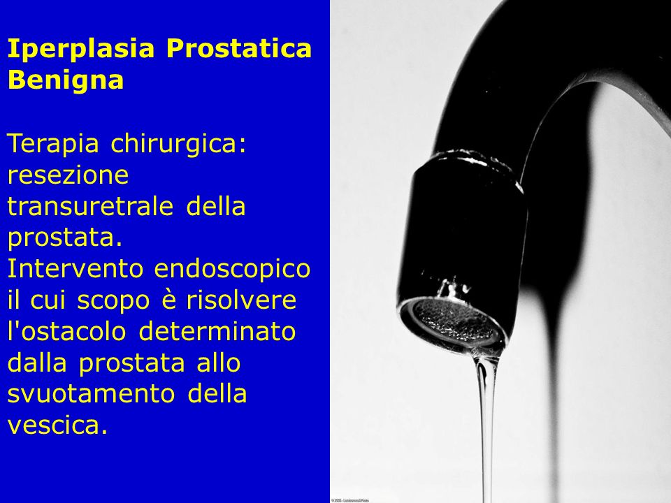 Iperplasia Prostatica Benigna
