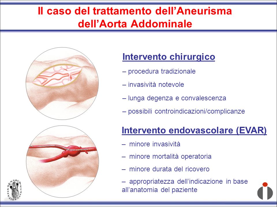 Il caso del trattamento dell’Aneurisma dell’Aorta Addominale