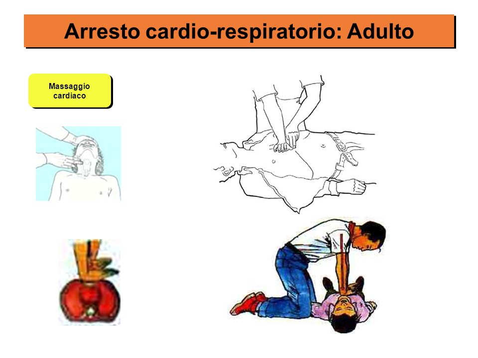 Arresto cardio-respiratorio: Adulto