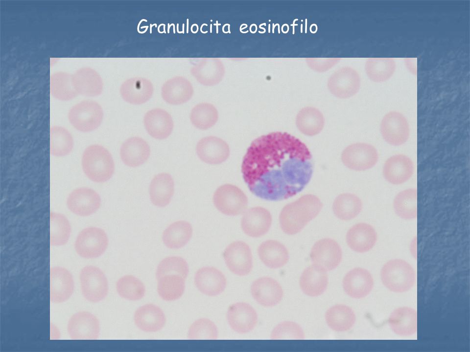 Granulocita eosinofilo