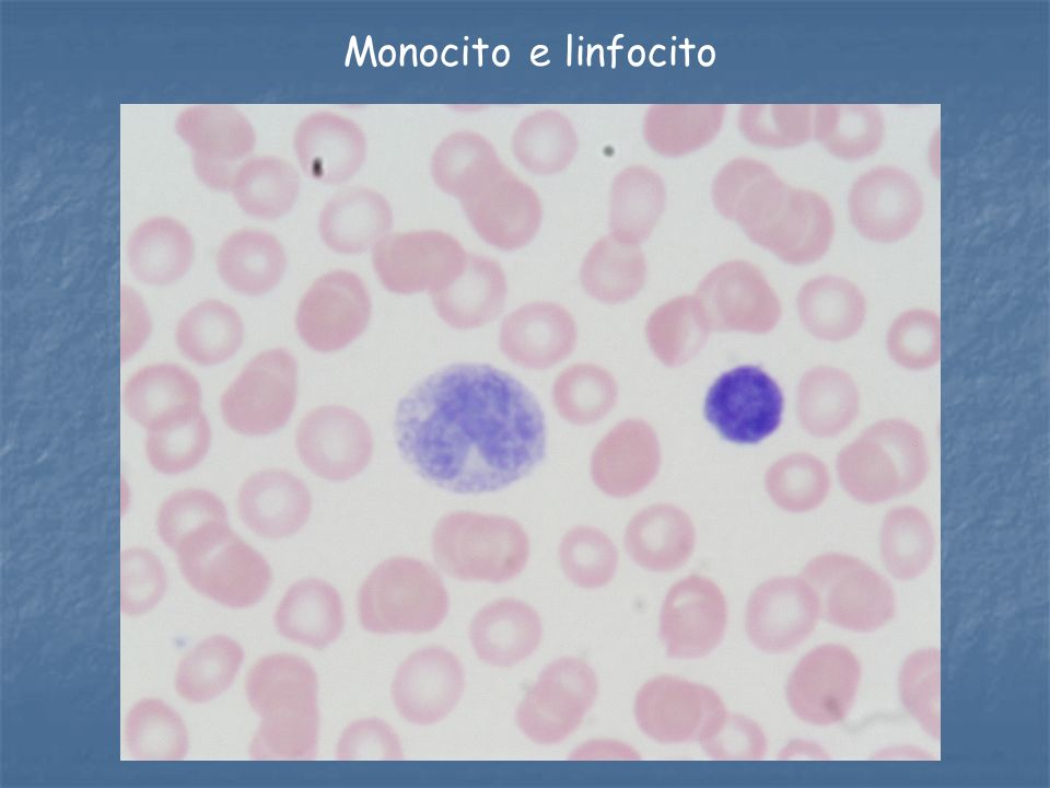 Monocito e linfocito
