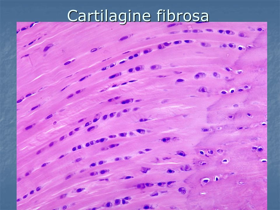 Cartilagine fibrosa