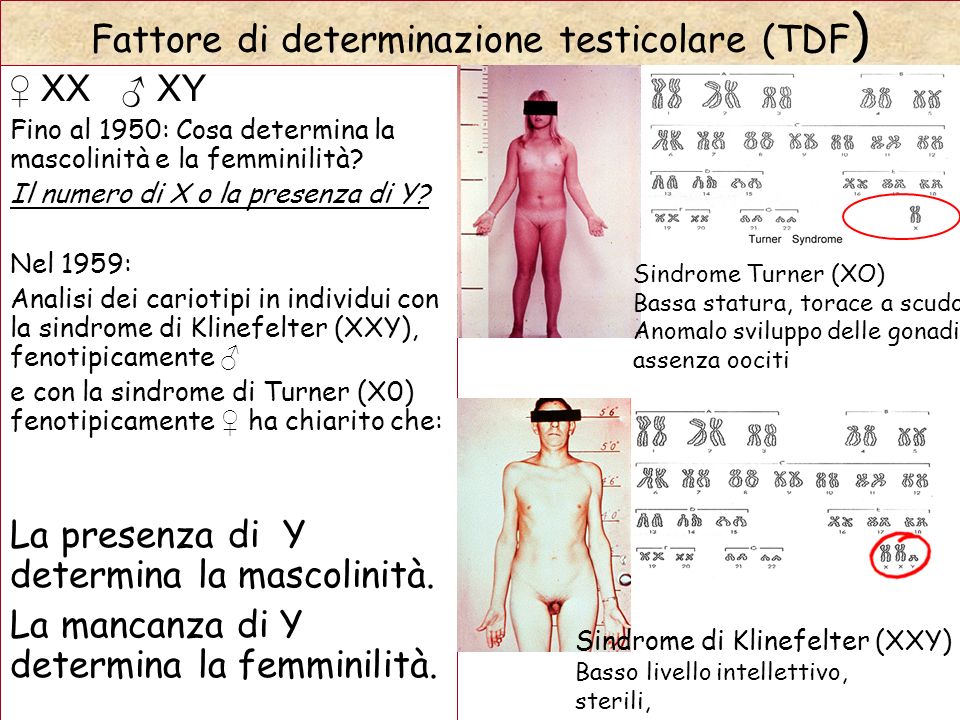 Fattore di determinazione testicolare (TDF)