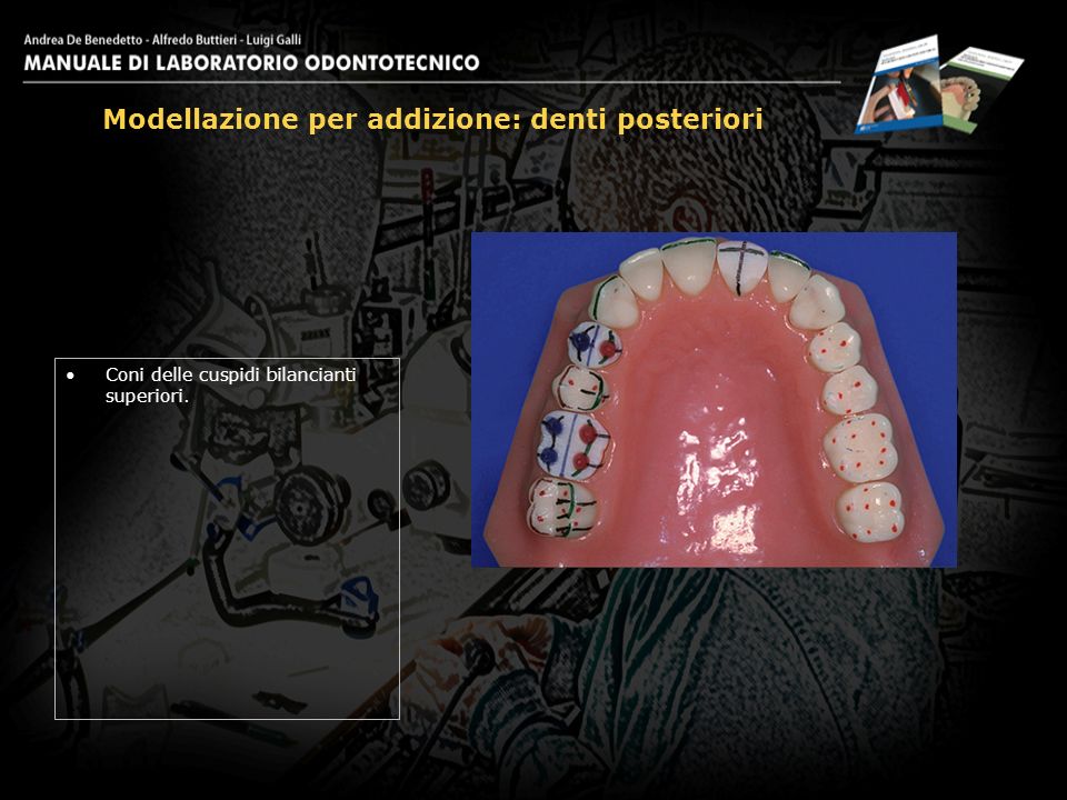 Modellazione per addizione: denti posteriori