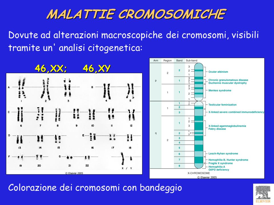 MALATTIE CROMOSOMICHE