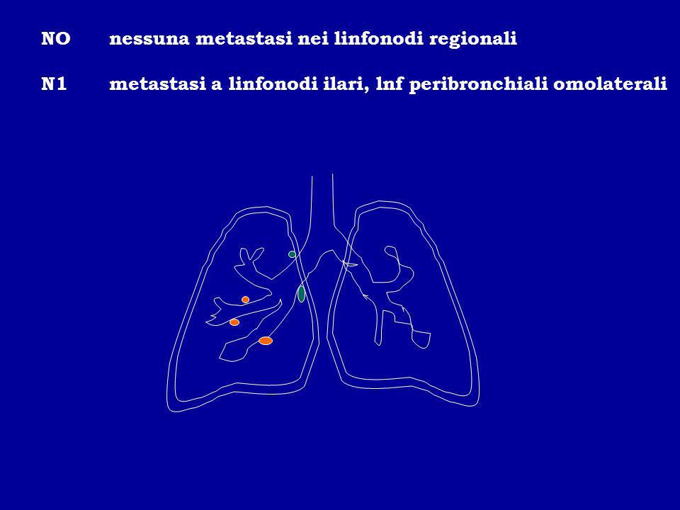 NO nessuna metastasi nei linfonodi regionali