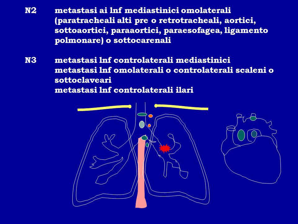N2. metastasi ai lnf mediastinici omolaterali