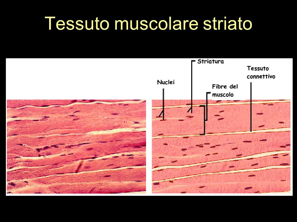 Tessuto muscolare striato