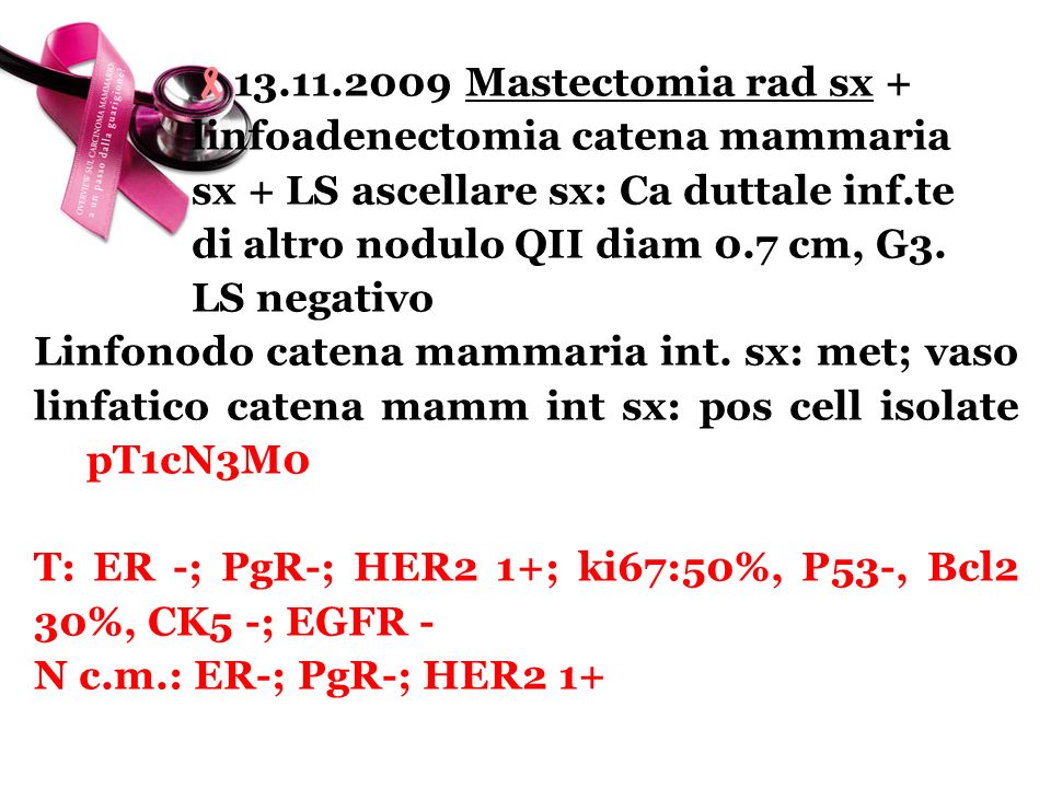  Mastectomia rad sx +. linfoadenectomia catena mammaria