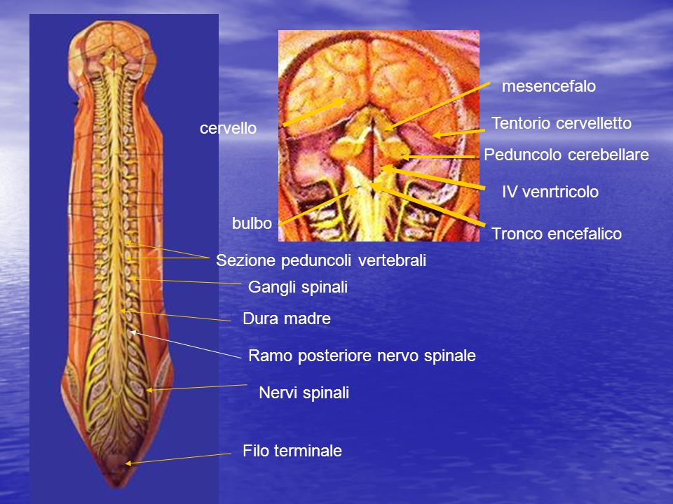 mesencefalo Tentorio cervelletto. cervello. Peduncolo cerebellare. IV venrtricolo. bulbo. Tronco encefalico.