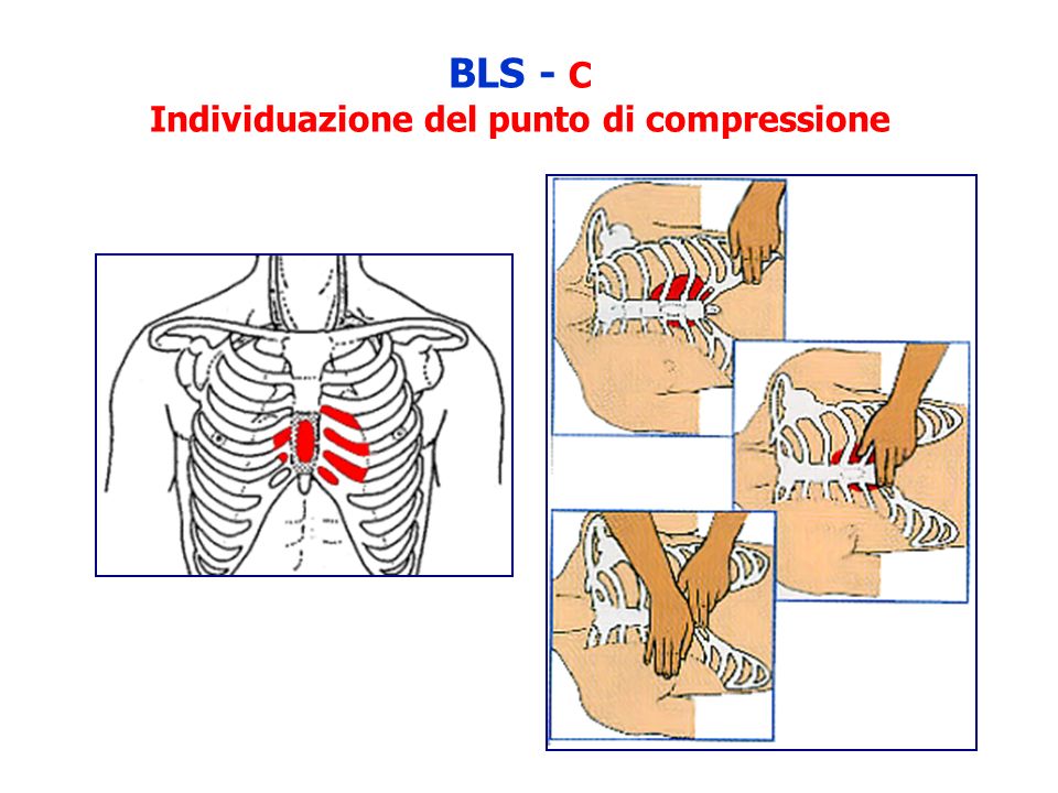 BLS - C Individuazione del punto di compressione